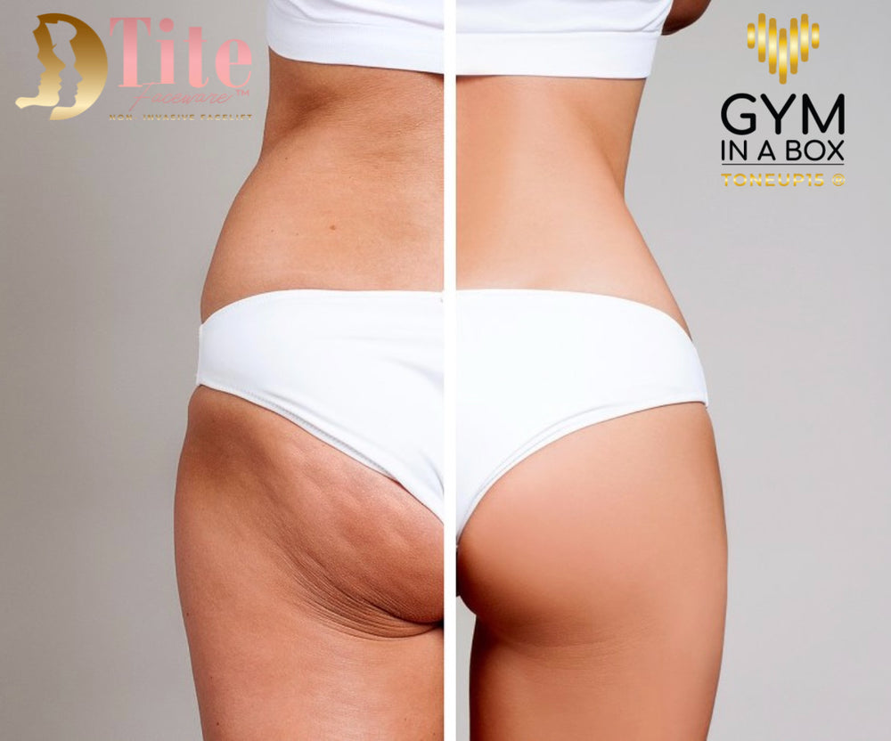 4 Tips to Reduce Cellulite that Take Little Time and Effort