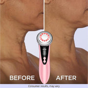 MegaBeauty Wand, Fit & Firm Sculpting Gel Non Surgical Neck Lift, Goodbye Turkey Neck, Before and After, Neck Lift, Neck lines, Facial Rejuvenating , Skin Rejuvenation, Eye care mode, neck lifting mode