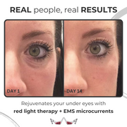 IGLOW Dark Circles Eraser E-Glasses