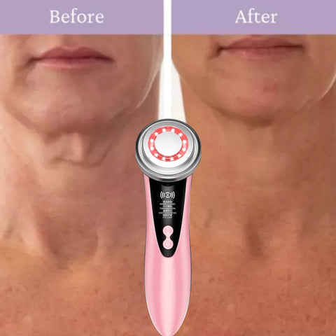 MegaBeauty Wand, Fit & Firm Sculpting Gel Non Surgical Neck Lift, Goodbye Turkey Neck, Before and After, Neck Lift, Neck lines, Facial Rejuvenating , Skin Rejuvenation, Eye care mode, neck lifting mode