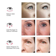 I Glow Dark Circles Under Eye Rejuvenator, Best Solution For Eye Bags, Dark Eye Circle Treatment, Bags Under Eyes Men, Reduce Eye Bags 