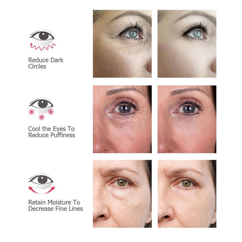 I Glow 3D Under Eye Rejuvenator, Best Solution For Eye Bags, Dark Eye Circle Treatment, Bags Under Eyes Men, Reduce Eye Bags 