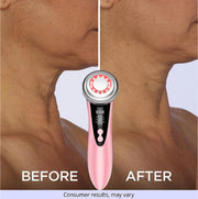 MegaBeauty Wand, Goodbye Turkey Neck, Before and After, Neck Lift, Neck lines, Facial Rejuvenating , Skin Rejuvenation, Eye care mode, neck lifting mode, consumer results