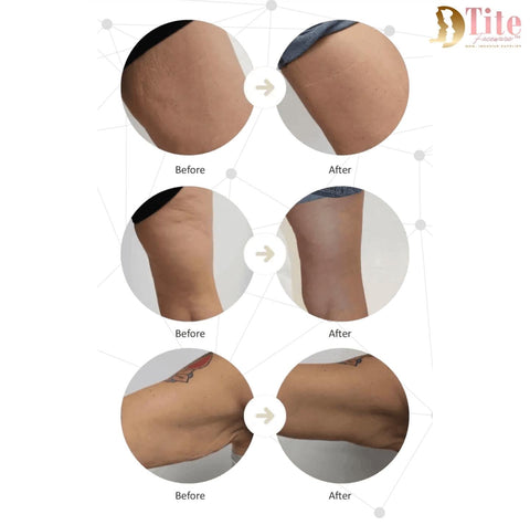 GIAB Magic Beauty Kit Fit And Firm Before After