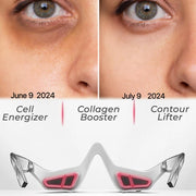 I Glow 3D Dark Circles Eraser, before after , dark circle eraser 