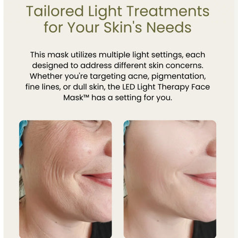 Before-and-after comparison of wrinkle reduction using the Magic Glow LED BeautyShield; results show smoother and firmer skin texture.
