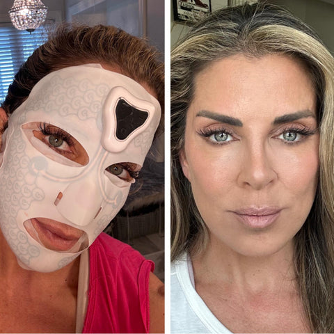 Goodbye Saggy Jowls Before After MicroCurrent FaceLift Mask, Best Skin Firming Treatment, Best Skin Tightening Procedure, Tighten Lose Skin, Skin Tightening Therapy FaceLift Mask ToneUp®️ 15 Min Facelift Mask , Saggy Skin Treatment