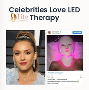 Magic Glow Premium LED Face And Neck Beauty Light, Green LED Light Therapy, Yellow Light Therapy, LED Light Skin Therapy 