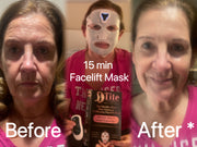 Miracle FaceLift Mask